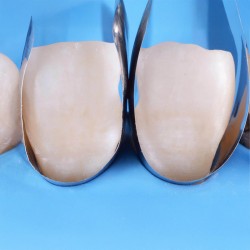Unica Intro Kit Polydentia