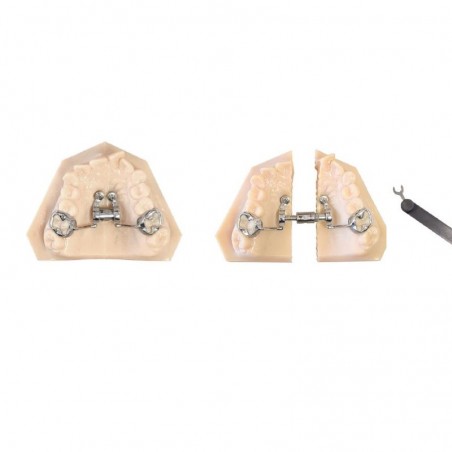 Surub disjunctie Telescopic CAD – CAM Expander 14mm Leone