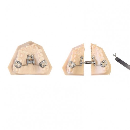 Surub disjunctie Telescopic CAD – CAM Expander 18mm Leone