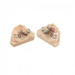 Mini-surub disjunctie auto-activ Mini Leaf Self Expander CAD - CAM 6mm 600g Leone