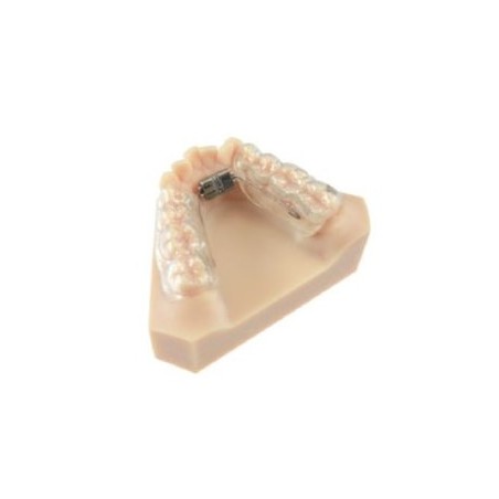 Mini-surub disjunctie 2 brate Hybrid Mode Expander 4mm 600g Leone