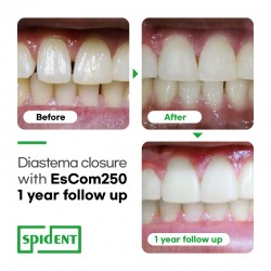 EsCom250 seringa 4g Spident