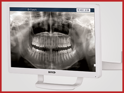 Monitor-Barco-22.png